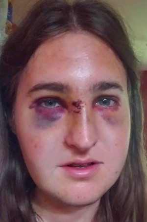 My Summer Mishap and the Power of Alternative Medicine